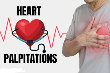 Heart Palpitations